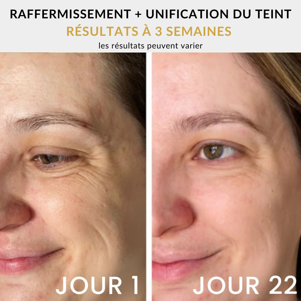 SilkiSculpt™ - Lifting Luminothérapie Visage & Cou