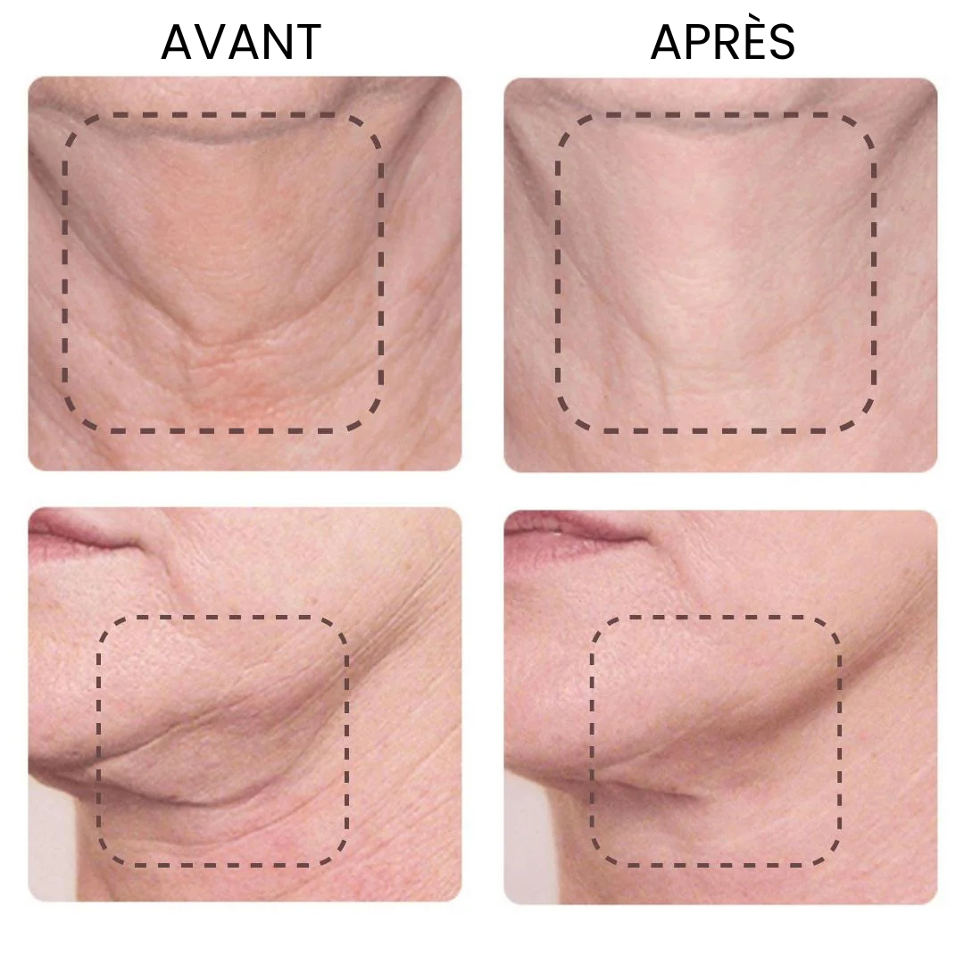 SilkiSculpt™ - Lifting Luminothérapie Visage & Cou